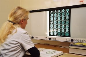 Brain Injury